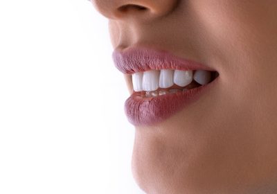 Diş Sıkma Botoksu: Masseter Uygulaması ve Etkileri 2026