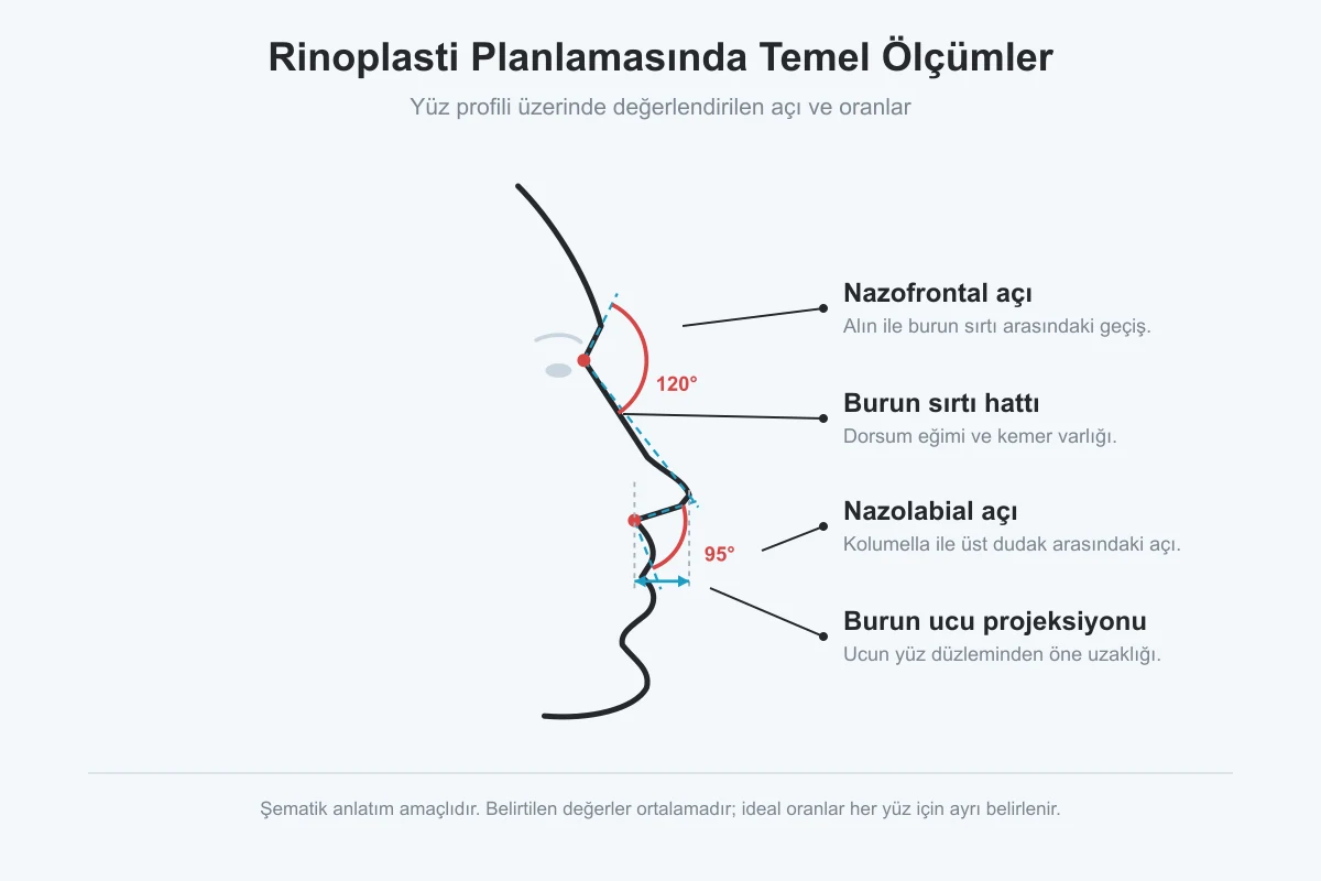 Rinoplasti yüz analizinde değerlendirilen açı ölçümleri: nazofrontal açı, nazolabial açı ve burun ucu projeksiyonu